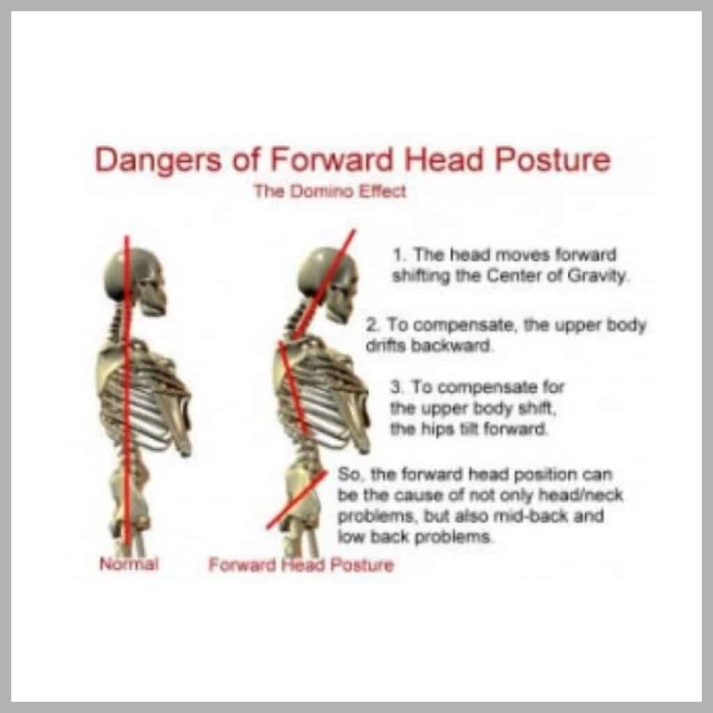 Two skeletons showing correct head posture.