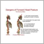 Two skeletons showing correct head posture.