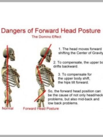 Two skeletons showing correct head posture.