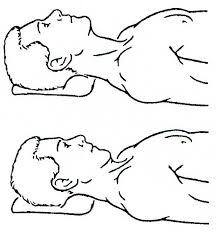 Suboccipital stretch shown in sketch.